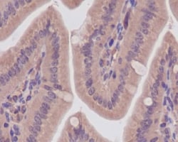 CaM Kinase II Antibody (SR1753), Novus Biologicals:Antibodies:Primary Antibodies