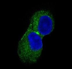 CaM Kinase II Antibody (SR1753), Novus Biologicals:Antibodies:Primary Antibodies
