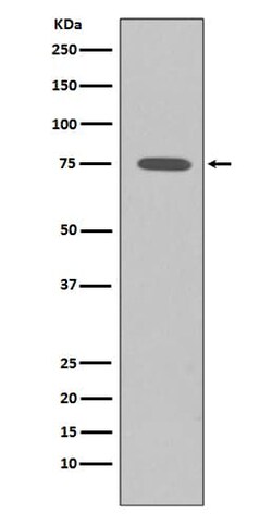 Somatostatin R2/SSTR2 Antibody (SR1695), Novus Biologicals 100 &mu;g; Unconjugated:Antibodies,