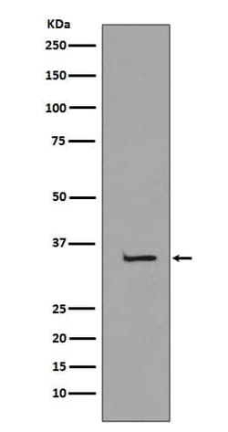 TATA binding protein TBP Antibody (SR1605), Novus Biologicals:Antibodies:Primary