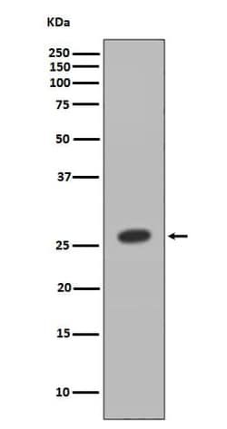 HOXB9 Antibody (SR1469), Novus Biologicals 100 &mu;g; Unconjugated:Antibodies,