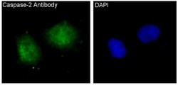 Caspase-2 Antibody (SR1824), Novus Biologicals 100 &mu;g | Buy Online | Novus Biologicals | Fisher Scientific