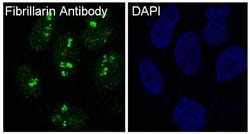 Fibrillarin Antibody (SR1545), Novus Biologicals:Antibodies:Primary Antibodies