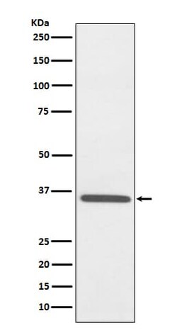 Fibrillarin Antibody (SR1545), Novus Biologicals:Antibodies:Primary Antibodies
