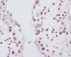 Fibrillarin Antibody (SR1545), Novus Biologicals:Antibodies:Primary Antibodies