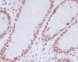 LSD1 Antibody (SR1059), Novus Biologicals:Antibodies:Primary Antibodies