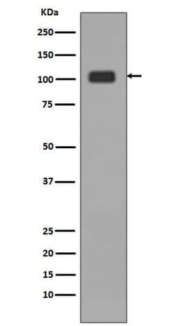 LSD1 Antibody (SR1059), Novus Biologicals:Antibodies:Primary Antibodies