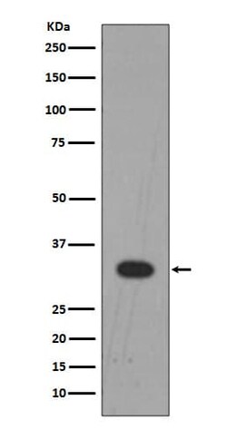 LIN-28B Antibody (SR1509), Novus Biologicals 50 &mu;g; Unconjugated:Antibodies,