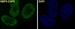 p21/CIP1/CDKN1A Antibody (SR1330), Novus Biologicals 100 &mu;g; Unconjugated:Antibodies,
