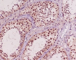 AKT1/2/3 Antibody (SR2006), Novus Biologicals:Antibodies:Primary Antibodies