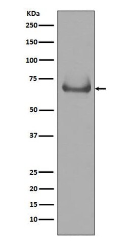 Lamin B Receptor Antibody (SR2150), Novus Biologicals 100 &mu;g; Unconjugated:Antibodies,