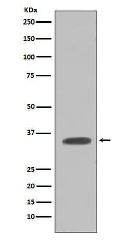 Caspase-7 Antibody (SR1559), Novus Biologicals 50 &mu;g | Buy Online | Novus Biologicals | Fisher Scientific