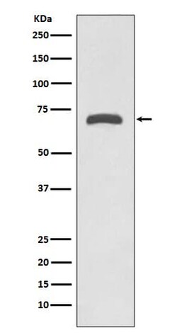 MMP-8 Antibody (SR1941), Novus Biologicals:Antibodies:Primary Antibodies