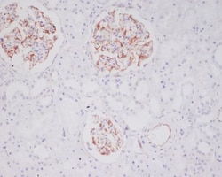 Tryptase alpha/beta 1 Antibody (SR1510), Novus Biologicals:Antibodies:Primary