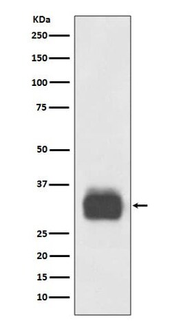 Tryptase alpha/beta 1 Antibody (SR1510), Novus Biologicals:Antibodies:Primary