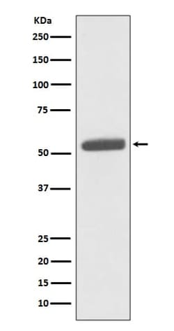 PKM2 Antibody (SR2031), Novus Biologicals 100 &mu;g; Unconjugated:Antibodies,