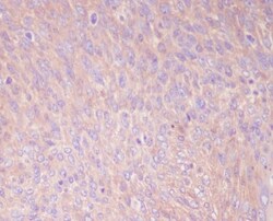 PKM2 Antibody (SR2031), Novus Biologicals 100 &mu;g; Unconjugated:Antibodies,