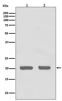 IL-1ra/IL-1F3/IL1RN Antibody (SR1317), Novus Biologicals:Antibodies:Primary
