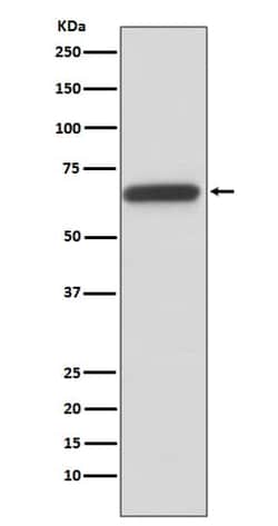 TCF-2/HNF-1 beta Antibody (SR2073), Novus Biologicals 100 &mu;g; Unconjugated:Antibodies,