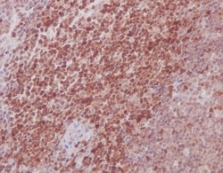 MKK3/MKK6 Antibody (SR1645), Novus Biologicals 100 &mu;g; Unconjugated:Antibodies,
