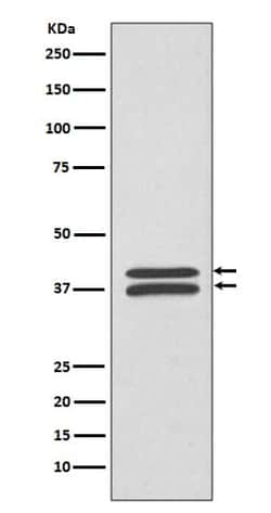 MKK3/MKK6 Antibody (SR1645), Novus Biologicals 100 &mu;g; Unconjugated:Antibodies,