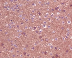 Trk (pan) Antibody (SR1160), Novus Biologicals:Antibodies:Primary Antibodies