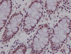 CDCA5 Antibody (SR1580), Novus Biologicals:Antibodies:Primary Antibodies