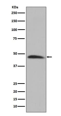Hsp47 Antibody (SR1796), Novus Biologicals 50 &mu;g; Unconjugated:Antibodies,