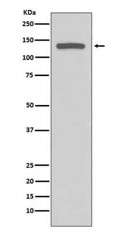 iNOS Antibody (SR1134), Novus Biologicals:Antibodies:Primary Antibodies