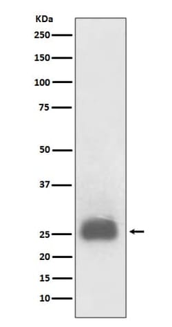 TIMP-1 Antibody (SR1425), Novus Biologicals 50 &mu;g; Unconjugated:Antibodies,