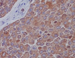 Mitofusin 2 Antibody (SR2236), Novus Biologicals 50 &mu;g; Unconjugated:Antibodies,