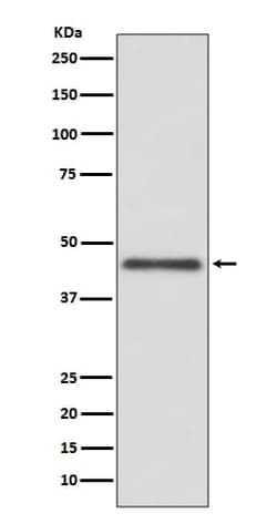HLA G Antibody (SR1708), Novus Biologicals 100 &mu;g | Buy Online | Novus Biologicals | Fisher Scientific