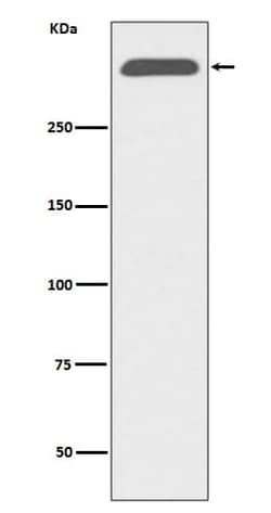 Apolipoprotein B/ApoB Antibody (SR1898), Novus Biologicals 100 &mu;g; Unconjugated:Antibodies,