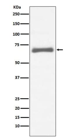 alpha-Fetoprotein/AFP Antibody (SR2120), Novus Biologicals:Antibodies:Primary