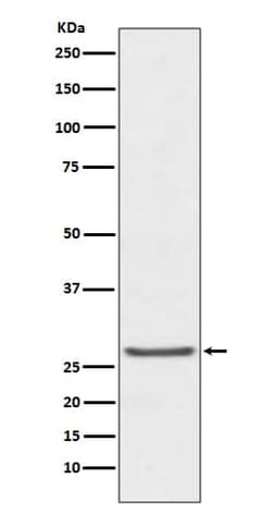 TIMP-1 Antibody (SR1426), Novus Biologicals 50 &mu;g; Unconjugated:Antibodies,