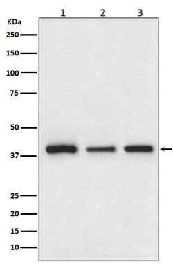 Cathepsin L/V/K/H Antibody (SR1633), Novus Biologicals 100 &mu;g; Unconjugated:Antibodies,