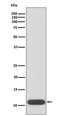 HBG1/2 Antibody (SR1114), Novus Biologicals:Antibodies:Primary Antibodies