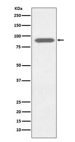Lactoferrin Antibody (SR2218), Novus Biologicals 100 &mu;g, Unconjugated:Antibodies,