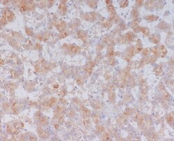 Serum Amyloid A1/A2 Antibody (SR1117), Novus Biologicals:Antibodies:Primary