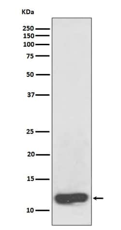 Serum Amyloid A1/A2 Antibody (SR1117), Novus Biologicals:Antibodies:Primary
