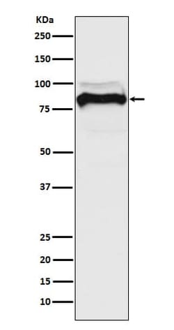 TGF-beta RII Antibody (SR2244), Novus Biologicals:Antibodies:Primary Antibodies