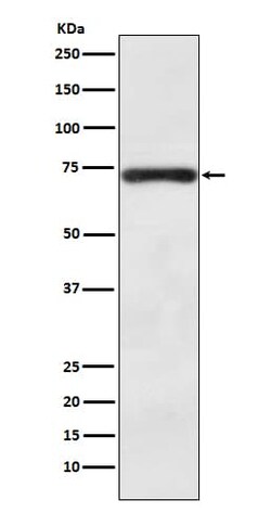 BACE-1 Antibody (SR2142), Novus Biologicals 100 &mu;g; Unconjugated:Antibodies,