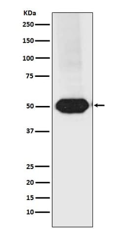 MEF2A/C Antibody (SR1902), Novus Biologicals 50 &mu;g; Unconjugated:Antibodies,