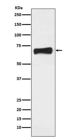 LRH-1/NR5A2 Antibody (SR2100), Novus Biologicals 100 &mu;g; Unconjugated:Antibodies,