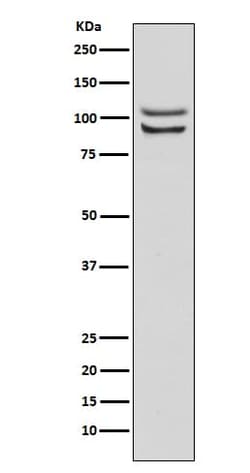 FGFR4 Antibody (SR2266), Novus Biologicals:Antibodies:Primary Antibodies