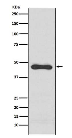 Serpin E1/PAI-1 Antibody (SR1779), Novus Biologicals 100 &mu;g; Unconjugated:Antibodies,