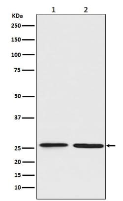 BNIP1 Antibody (SR1417), Novus Biologicals 100 &mu;g; Unconjugated:Antibodies,