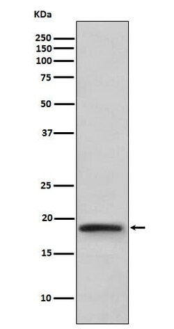 Lymphotoxin-alpha/TNF-beta Antibody (SR1300), Novus Biologicals 100 &mu;g;
