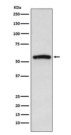 IRAK4 Antibody (SR1922), Novus Biologicals:Antibodies:Primary Antibodies