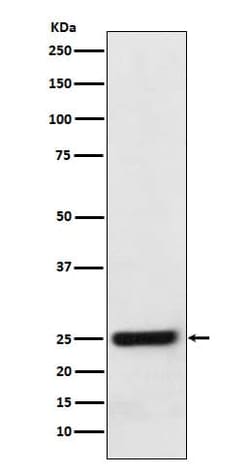 ERAB Antibody (SR1440), Novus Biologicals:Antibodies:Primary Antibodies